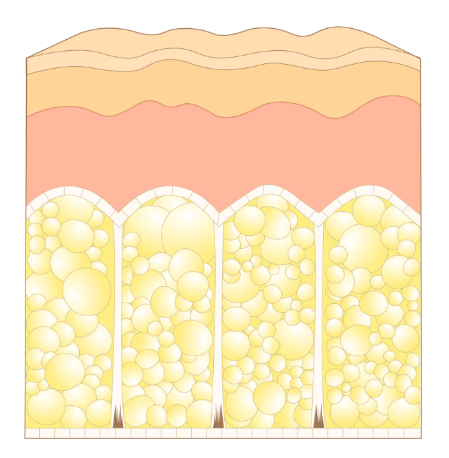 Cross-Section of Cellulite