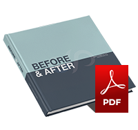 Before and After eBook