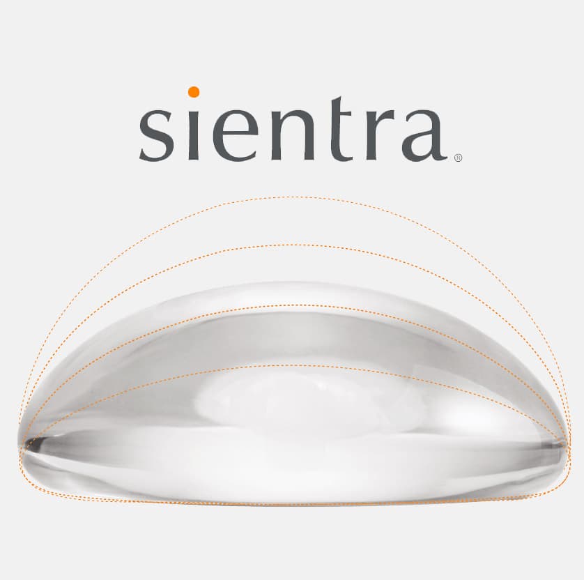 Sientra Breast Implants