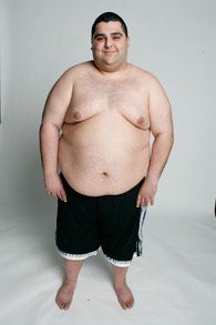 Neil Tejwani of the biggest loser before photo