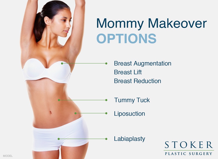 Photo illustration showing Mommy makeover options