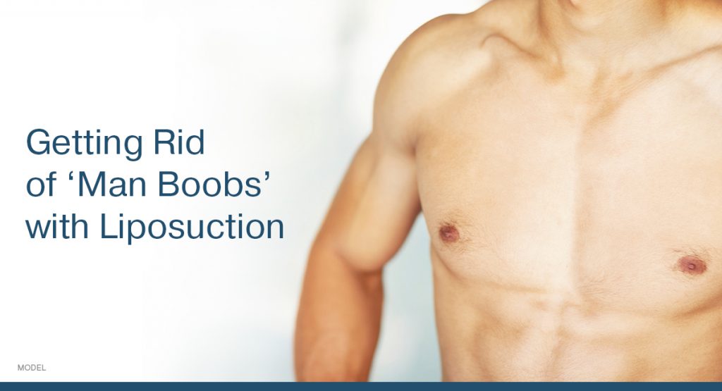 Getting Rid of 'Man Boobs' With Liposuction