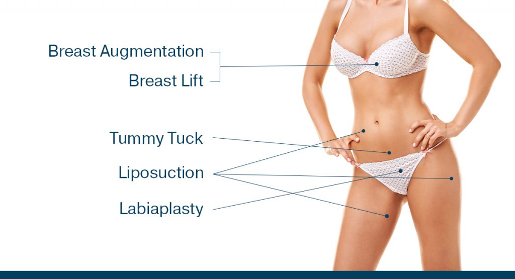 Illustration showing areas often treated in mommy makeover surgery