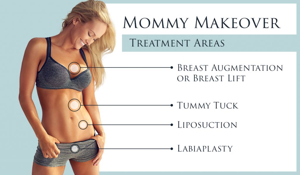 Image of a woman showing the Mommy Makeover treatment areas. Breast enhancement, Tummy Tuck, Liposuction, and Labiaplasty.