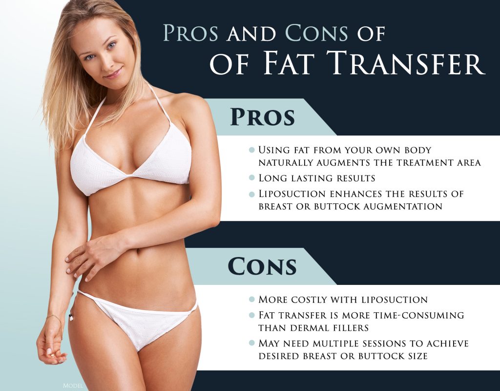 Complete Guide to Fat Transfer in Los Angeles