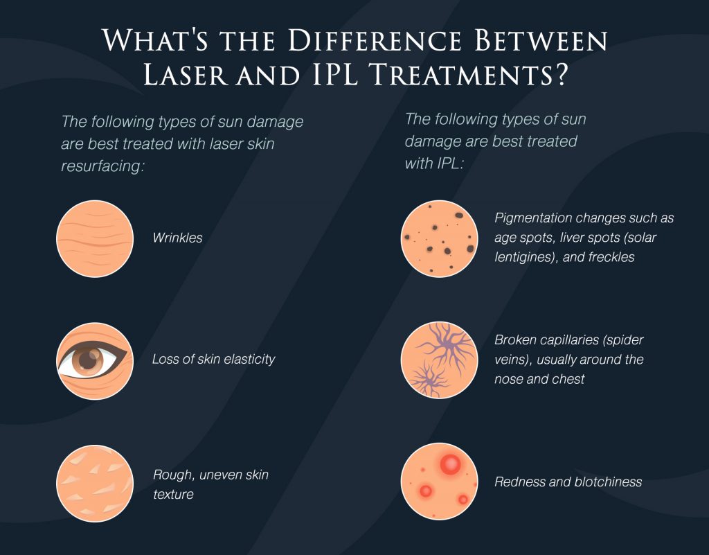 Infographic explaining the difference between laser and IPL treatments