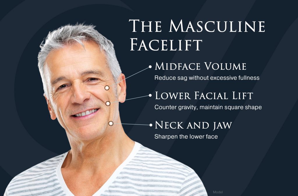 Infographic displaying the different areas of a man's face that can be treated with a facelift