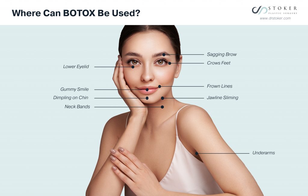 Where can BOTOX be used?