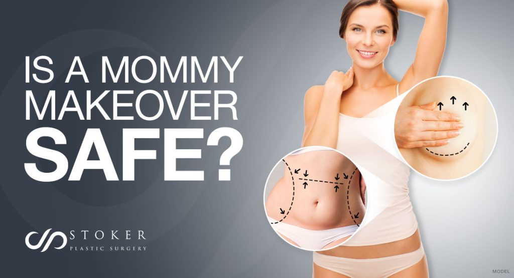 Is mommy makeover safe? Woman raising her arm over her head with a focus on her stomach and breast (model)