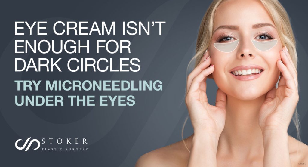 Woman holding her face and smiling (model) with text: Eye Cream Isn’t Enough for Dark Circles—Try Microneedling Under the Eyes