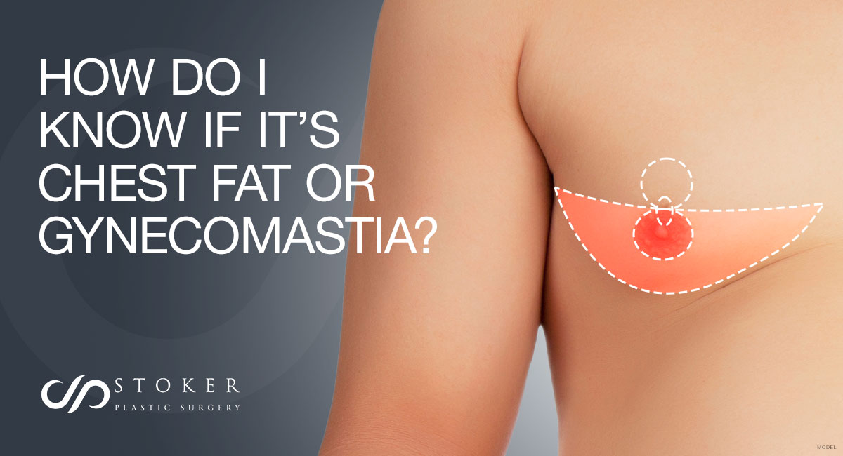 How Do I Know if It's Chest Fat or Gynecomastia? – Dr. David Stoker