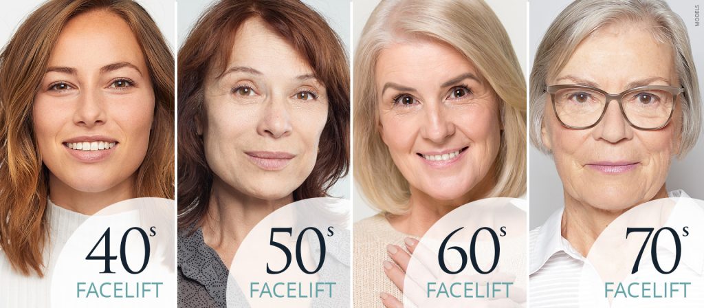 40s Facelift, 50s Facelift, 60s Facelift, 70s Facelift. 4 women after their facelift procedure (models)