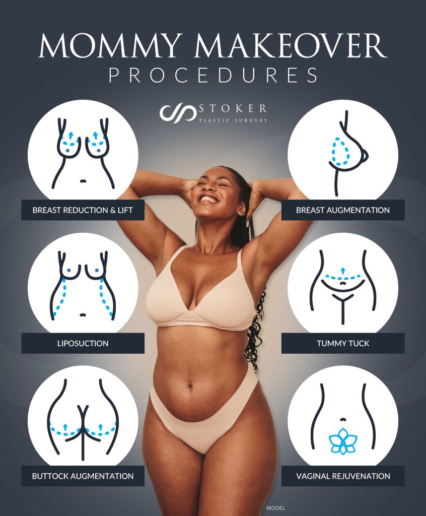 Mommy Makeover Procedures. Woman in lingerie standing with her hands on her head (model)