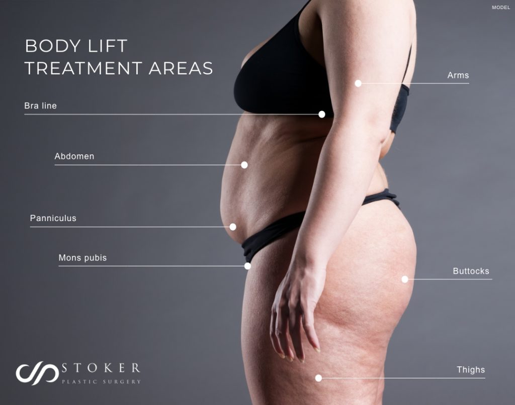 Infographic displaying different areas of the body that a body life procedure will address.