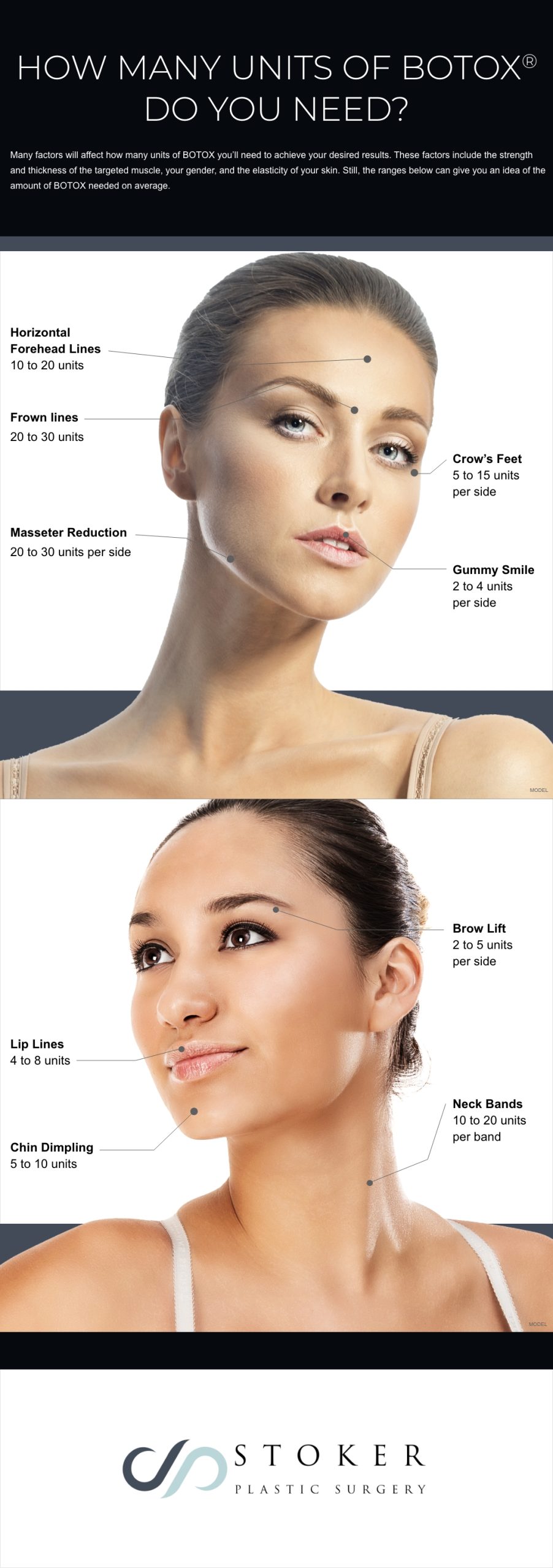 Infographic on "How many units of BOTOX® do you need?