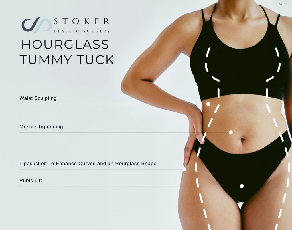 Infographic showcasing the areas of the body that an Hourglass Tuck can transform and what procedures are used for each area.