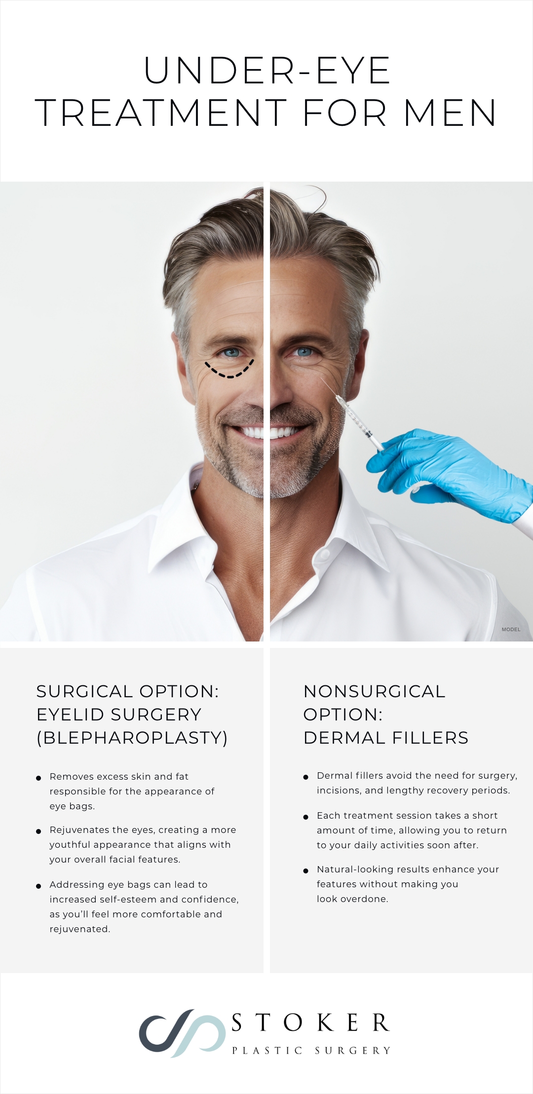 Inforgraphic of surgical vs. nonsurgical eye rejuvenation options for men and the benefits of each.