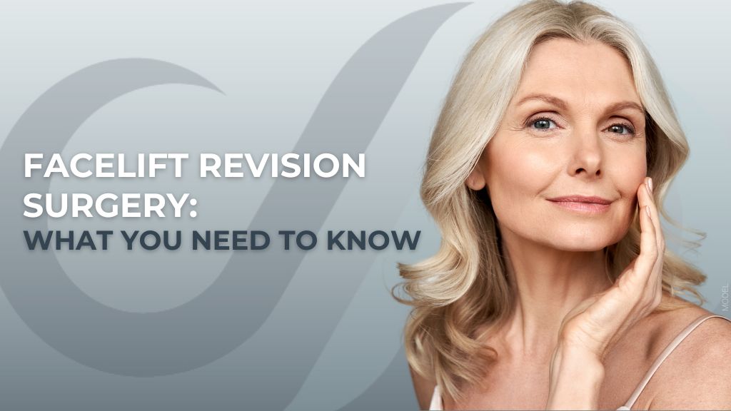 Mature woman with beautiful skin (model) and text that reads 'Facelift Revision Surgery: What You Need To Know'