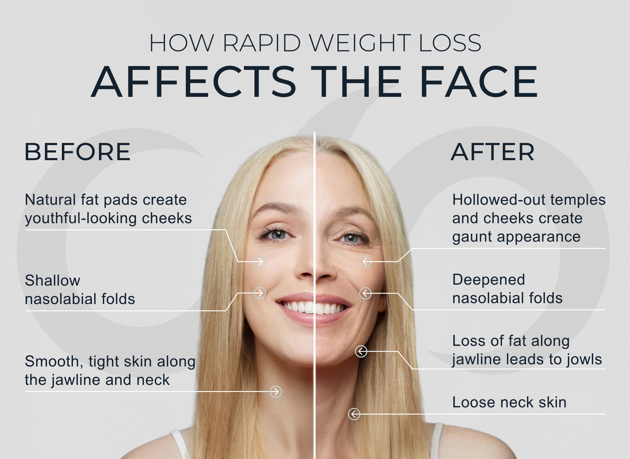 Infographic illustrating how rapid weight loss can impact facial appearance, highlighting effects like sagging skin, loss of volume, and changes in facial structure.