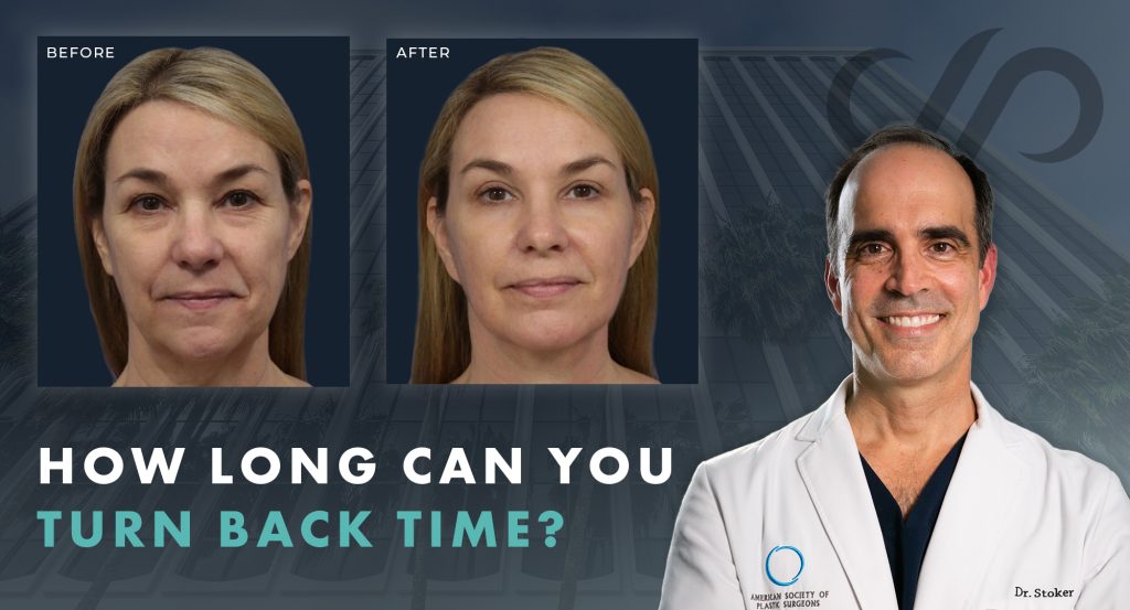 "How Long Can You Turn Back Time?" with a before and after facelift results by Dr. Stoker.