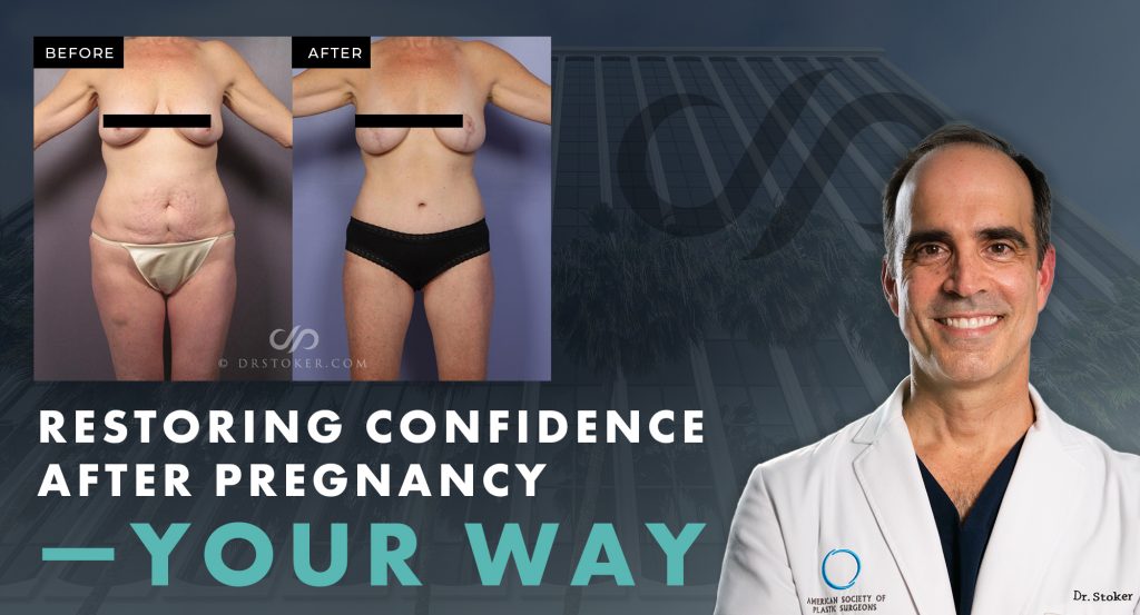 "Restoring confidence after pregnancy -- your way" with real patient result image.