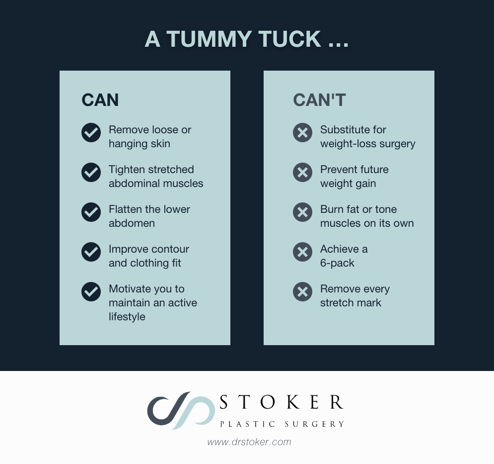 What a tummy tuck can and can't do.