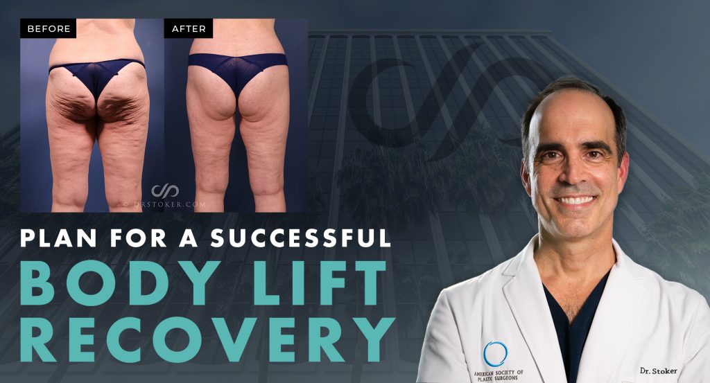 "Plan for a Successful Body Lift Recovery" with real patient before and after photos.