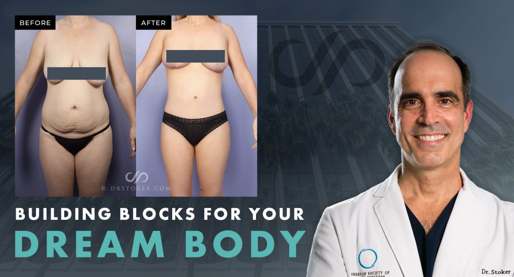 Real patient before-and-after mommy makeover results with a portrait of Dr. Stoker and “Dream Body” headline.