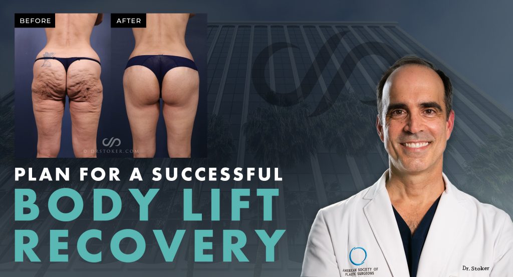 "Plan for a Successful Body Lift Recovery" with real patient before and after photos.