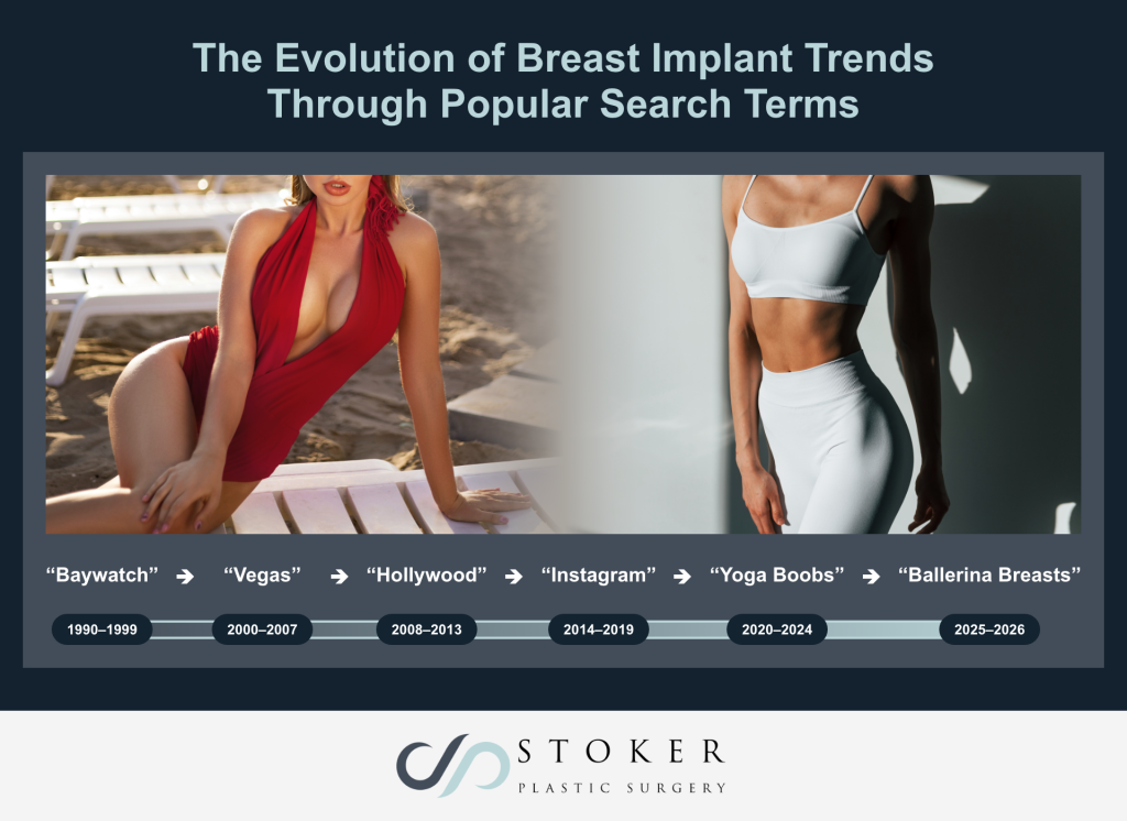 Graphic titled “The Evolution of Breast Implant Trends” by Stoker Plastic Surgery showing a timeline of changing breast augmentation aesthetics from 1990 to 2026.