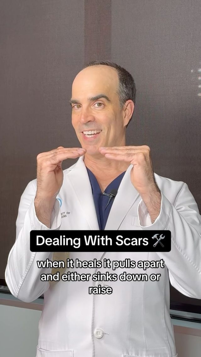Dealing With Scars 😳🛠 #scars 

✨Scars are never a favorite. At our practice, we aim to eliminate them effectively. Firstly, we strategically plan incisions to hide them. Then, during closure, I employ advanced plastic surgery methods to reduce tension, like multilayer closure and undermining. This minimizes scarring. 

✨Additionally, we ensure edges are everted to promote optimal healing. We also offer post-operative care using lasers, silicone tape, kenalog injections, and microneedling to further enhance results over time.

BOOK NOW | in-office or virtual appointments by sending your name, number, and email to the DM. 

📲 CALL US | questions regarding treatment: (310) 300-1779

📩Email: Info@drstoker.com

🛍 SHOP SKINCARE | Link in bio 🔗

COMMENT BELOW 🔽

.
.
.
.
#skintightening #abdominoplasty #liposuction #bodytransformation #plasticsurgery #lowerbody #plasticsurgeon #cosmeticsurgery #surgery #mommymakeover #bodycontouring #beauty #physique #weightloss #liposculpture #weightlosstransformation #beforeandafter #bodycontouring #recovery #recoverytime #downtime #body #drstoker #boardcertifiedplasticsurgeon #postopcare #bodyshaping #fitness