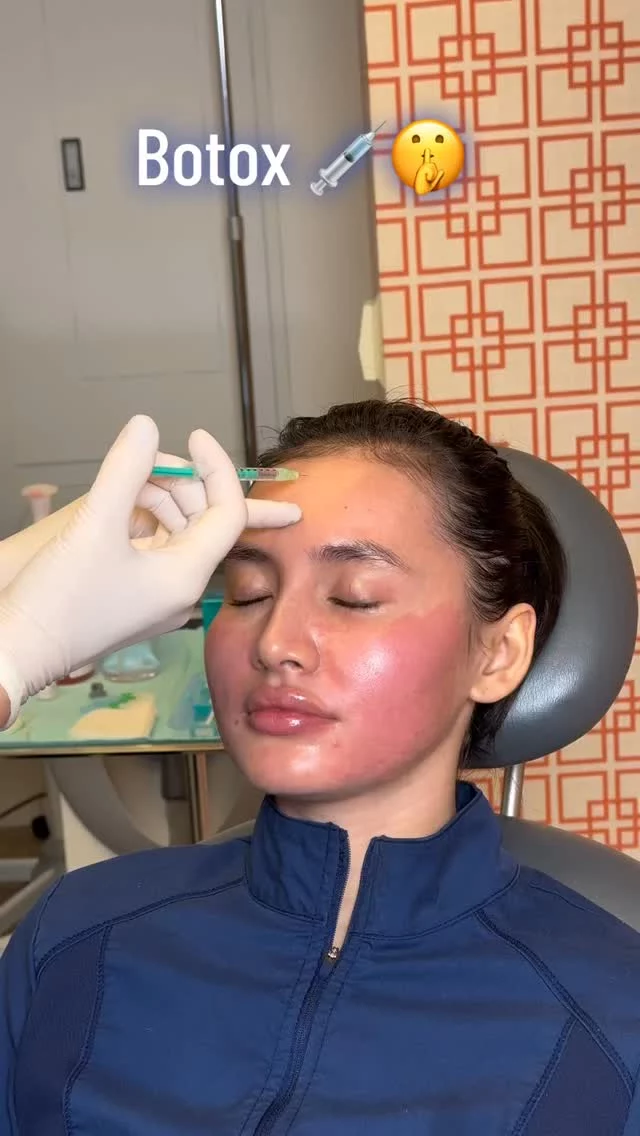 Press Pause on Aging! ✨ // #botox 

💉 Smooths wrinkles
💉 Prevents future lines
💉 Fast, minimal-downtime treatment

✨ As skin ages, collagen loss and reduced elasticity lead to fine lines and wrinkles, especially in the glabella, forehead, and around the eyes. Botox works by temporarily blocking nerve signals to relax facial muscles, softening existing lines and preventing new ones from forming.

👋BOOK NOW | In-office or virtual appointments by sending your name, number, and email to the DM. 

📲 CALL US | questions regarding treatment: (310) 300-1779

📩Email: Info@drstoker.com

🛍 SHOP SKINCARE | Link in bio 🔗

COMMENT BELOW 🔽
.
.
.
.
#dermalfiller #botox #beauty #antiaging #aesthetics #fillers #undereyefiller #dermalfiller #medicalspa #juvederm #skin #lipfiller #injectables #plasticsurgery #facial #cheekfiller #lips #esthetician #aestheticsexpert #facials #dermalfillers #selfcare #microneedling #dysport #bodycontouring #restylane #laser #skincareroutine