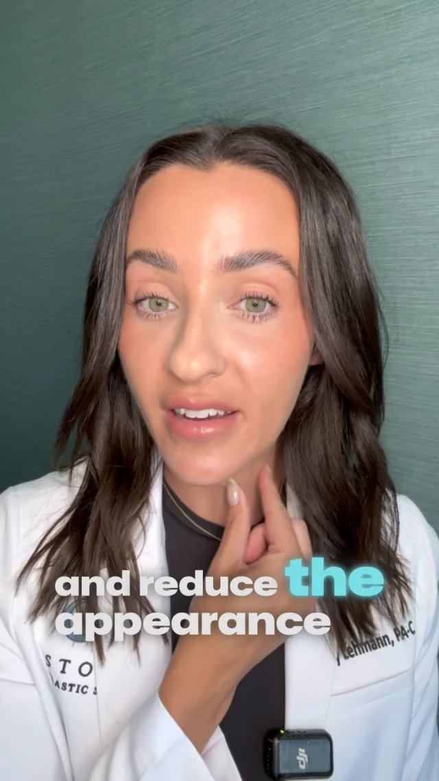Treating The Neck✨ // #beforeandafter 

✨ When it comes to treating the neck, the first step is always good skincare. Apply your retinol onto the neck, use collagen-boosting serums, and make sunscreen a daily habit. To build on that foundation, treatments like microneedling can help stimulate collagen and improve texture. 

✨ Botox can be used to smooth crepey skin, relax the platysma muscle, and reduce the appearance of neck bands. For deeper horizontal lines, a very light filler can be used to gently soften and smooth the area.

 
👋BOOK NOW | in-office or virtual appointments by sending your name, number, and email to the DM. 

📲 CALL US | questions regarding treatment: (310) 300-1779

📩Email: Info@drstoker.com

🛍 SHOP SKINCARE | Link in bio 🔗

COMMENT BELOW 🔽
.
.
.
.
#dermalfiller #botox #beauty #antiaging #aesthetics #fillers #undereyefiller #dermalfiller #medicalspa #juvederm #skin #lipfiller #injectables #plasticsurgery #facial #cheekfiller #lips #esthetician #aestheticsexpert #facials #dermalfillers #selfcare #microneedling #dysport #bodycontouring #restylane #laser #skincareroutiner