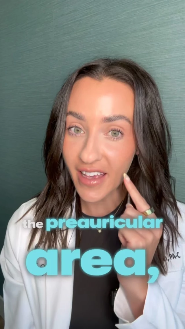 Sculptra for Facial Rejuvenation 🪄 ✨ // #medspa #cosmetics 

✨ Sculptra is a biostimulator that gradually improves skin texture, firmness, and subtle volume by stimulating collagen and elastin production. Unlike traditional fillers, it works over time with a series of treatments spaced about two months apart.

✨ Two key areas for placement are the temples and the preauricular region, beneath the cheekbone and above the jawline. In these zones, Sculptra enhances skin quality, supports a lifted brow, and reduces sagging without creating excess fullness.

👋BOOK NOW | In-office or virtual appointments by sending your name, number, and email to the DM. 

📲 CALL US | questions regarding treatment: (310) 300-1779

📩Email: Info@drstoker.com

🛍 SHOP SKINCARE | Link in bio 🔗

COMMENT BELOW 🔽
.
.
.
.
#dermalfiller #botox #beauty #antiaging #aesthetics #fillers #undereyefiller #dermalfiller #medicalspa #juvederm #skin #lipfiller #injectables #plasticsurgery #facial #cheekfiller #lips #esthetician #aestheticsexpert #facials #dermalfillers #selfcare #microneedling #dysport #bodycontouring #restylane #laser #skincareroutine