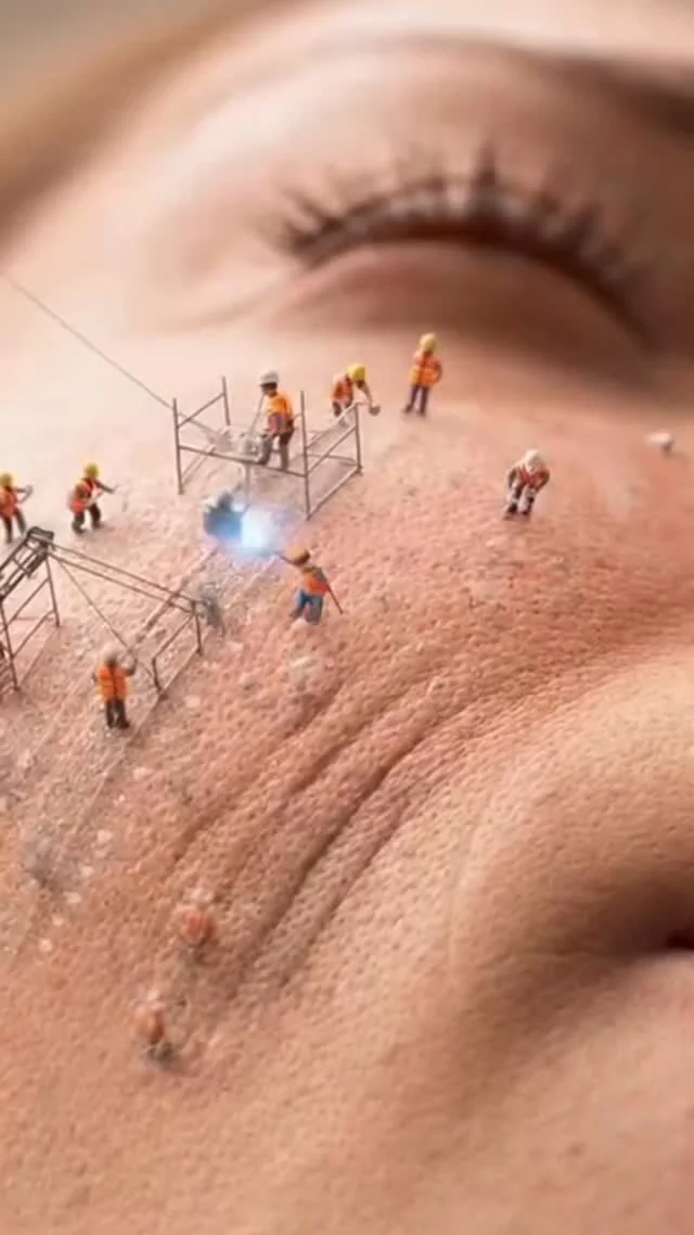 Maintenance for Aesthetic Treatment✨🙌// #aesthetictreatment 

💫 Healthy, radiant skin requires ongoing care, not just a single treatment.

✨ Morpheus8 RF Microneedling
Combines microneedling with radiofrequency to tighten and smooth skin while boosting collagen.

⏱️ 3 sessions, 4 weeks apart, then maintenance every 6 months.

✨ Microneedling with PRP
Uses fine needles and your own plasma to enhance collagen, refine texture, and minimize pores.

⏱️ Repeat every 6 months for lasting results.

✨ Fractional CO₂ Laser Skin Resurfacing 
Targets texture, sun damage, and scarring while deeply stimulating collagen.

⏱️ 1 treatment every 6–12 months, or a series for deeper concerns.

💫 Consistent maintenance keeps collagen strong and your skin smooth, firm, and youthful.

COMMENT 🔽

👋 BOOK NOW | in-office or virtual appointments by sending your name, number, and email to the DM.

📲 CALL US | questions regarding treatment: (310) 300-1779

🛍 SHOP SKINCARE | Link in bio 🔗
.
.
.
.
#botox #beauty #filler #skincare #juvederm #antiaging #lips #aesthetics #lipfiller #dysport #plasticsurgery #youth #prp #dermalfillers #microneedling #laser #microneedling  #restylane #lipfillers #aesthetic #medspa #injectables #facial #skin #morpheus8 #plasticsurgery #skin