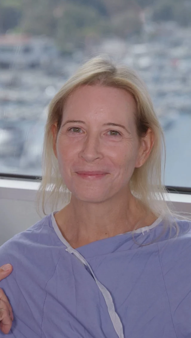 Amazing CO2 Laser Resurfacing 🥰✨ // #rejuvenation 

🥰 Two months after her fractional CO₂ laser, our patient already has smoother, clearer skin with fewer sunspots and fine lines. She’s still healing, so more tightening and refinement are expected in the months ahead. Next, she may choose a deep plane face and neck lift along with another laser session to build on these early results for a natural-looking glow up.

✅ BOOK NOW | in-office or virtual appointments by sending your name, number, and email to the DM. 

📲 CALL US | questions regarding treatment: (310) 300-1779

📩Email: Info@drstoker.com

🛍 SHOP SKINCARE | Link in bio 🔗

COMMENT BELOW 🔽
.
.
.
.
#plasticsurgery #co2laser